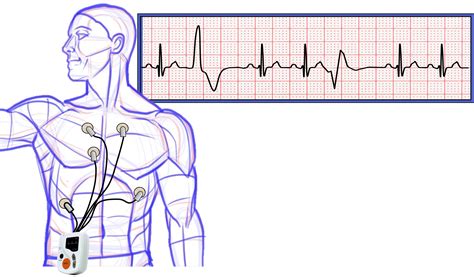 how to read holter monitor results|What To Expect From A Good Holter Monitor Reading.